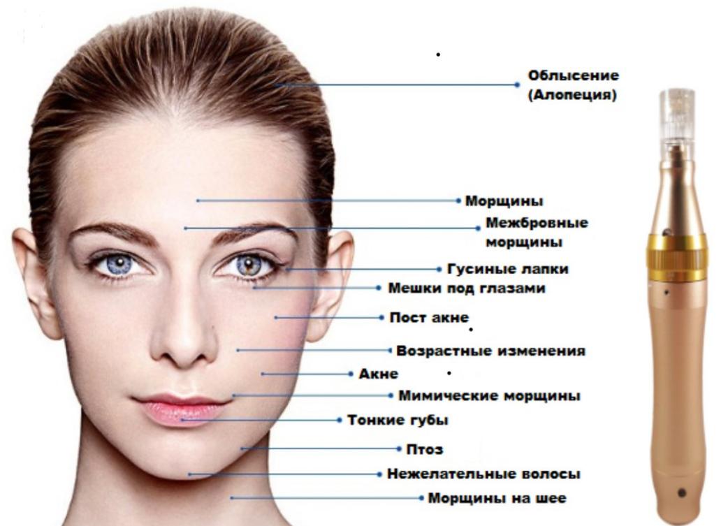 Микронидлинг лица – разновидность косметического ухода